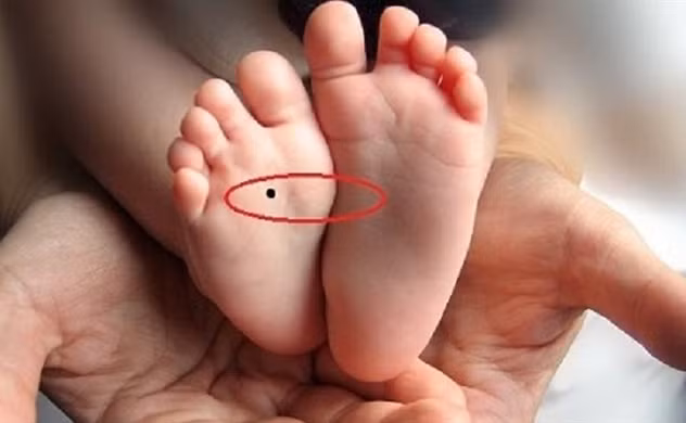 Nốt ruồi ở lòng bàn chân. Phụ nữ có nốt ruồi ở lòng bàn chân là người có năng lực vượt trội, có thể thể thành danh. Họ thường có vận khí tốt nên thường được nhiều người giúp đỡ. Dù thời trẻ, cuộc sống của họ khá khó khăn nhưng phụ nữ có nốt ruồi này không vì thế mà nản lòng, nhụt chí.