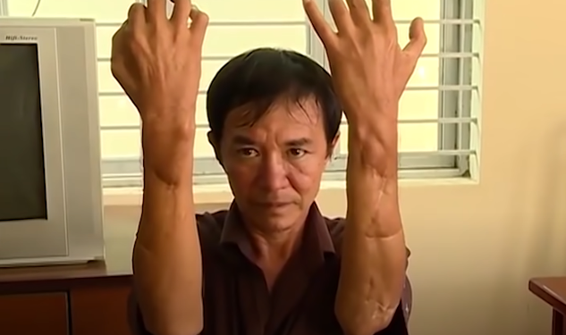 Ngày 15/1/2013, Hường hẹn vợ chồng chủ nợ là ông Nguyễn Chí Hùng và bà Phạm Ngọc Nga (ngụ xã Cù Bị, huyện Châu Đức) đến nhà riêng của mình để giải quyết chuyện nợ nần. Tại đây, Hường nói vợ chồng ông Hùng chờ chồng mình (khi đó là bí thư Đảng ủy xã Kim Long) về nói chuyện. Sau đó Hường dùng dao rựa chém nhiều nhát vào đầu và hai tay ông Hùng, bà Nga. Ông Hùng bị thương tật gần 80% còn vợ thì gần 30%.