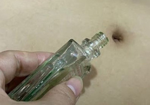 Chứng táo bón là một trong những chứng bệnh cực nhiều người mắc phải do thói quen ăn uống thiếu lành mạnh, không đủ chất. Mỗi tối trước khi đi ngủ, nếu bạn bôi một chút dầu gió vào rốn đó có thể thúc đẩy nhu động đường tiêu hóa hoạt động hiệu quả.