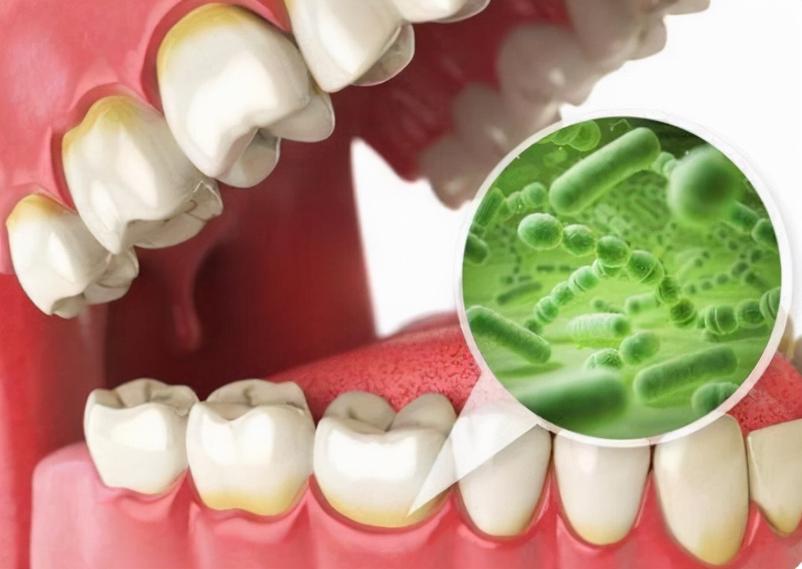 Sau khi ngủ dậy nếu uống nước luôn mà không đánh răng, những vi khuẩn này có thể xâm nhập vào cơ thể, ảnh hưởng đến sự cân bằng của ruột và hệ thực vật trong dạ dày, phá hủy niêm mạc dạ dày và gây ra các bệnh viêm nhiễm khác.