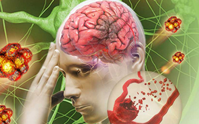 Thứ tư, có những trường hợp viêm huyết khối tắc nghẽn nặng, bệnh nhân sẽ bị loét da, hoại tử bên ngoài, nặng nhất có thể phải cắt cụt chi.