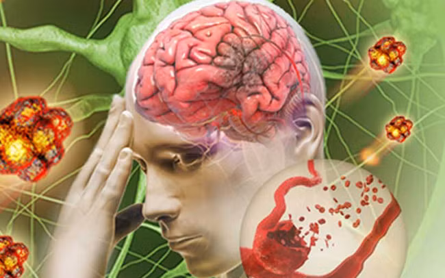 Thứ tư, có những trường hợp viêm huyết khối tắc nghẽn nặng, bệnh nhân sẽ bị loét da, hoại tử bên ngoài, nặng nhất có thể phải cắt cụt chi.