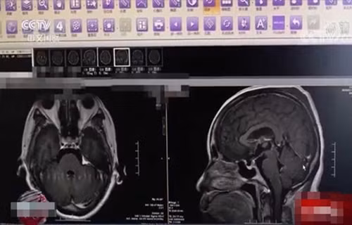 An mon nay de trong tu lanh, nguoi phu nu nguy kich tinh mang