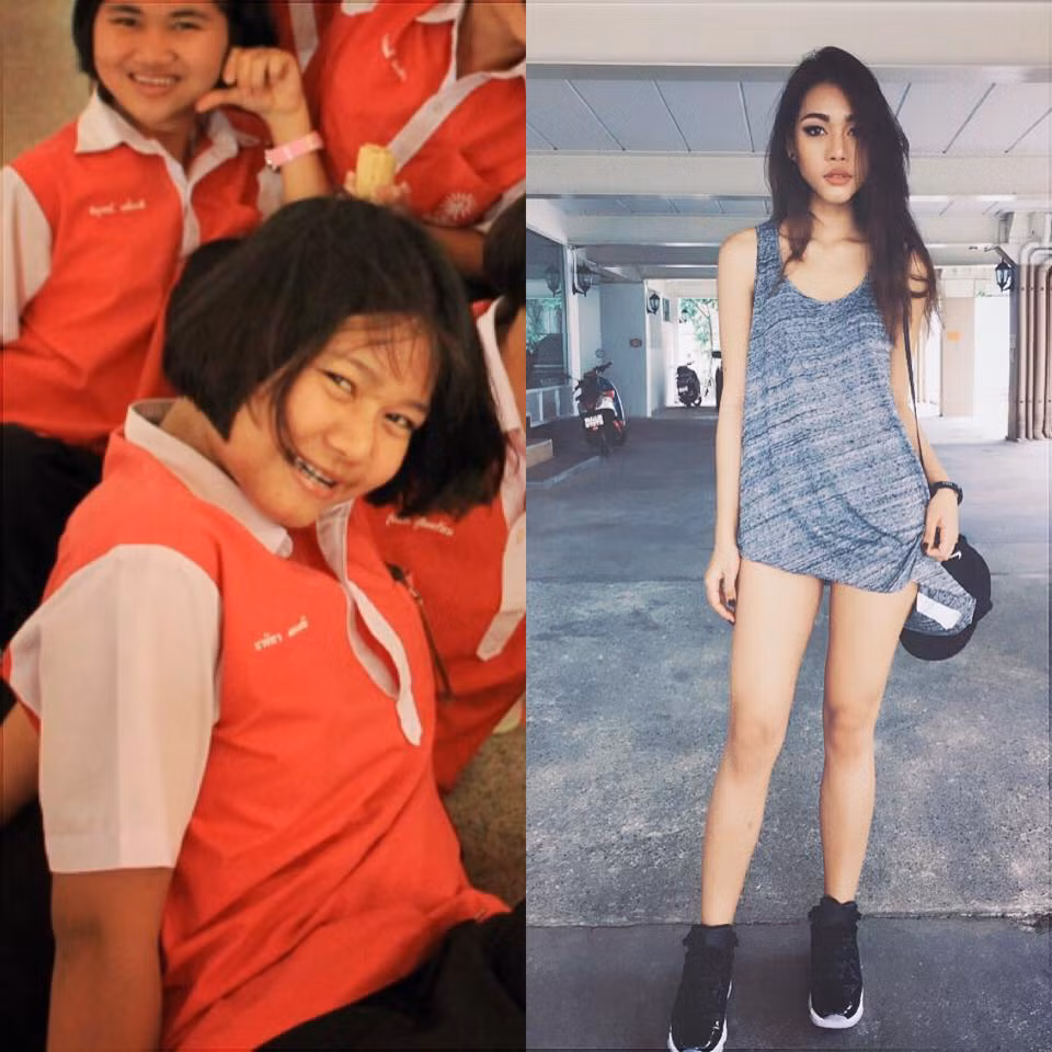 Ở Trung Quốc, Naika Nayika lại được mệnh danh là “nữ bác sĩ gợi cảm nhất châu Á”. Tuy nhiên, ít ai biết, trước đây Naika Nayika lại là một cô gái khá xấu xí, luôn tự ti vào bản thân và thường xuyên bị người khác trêu chọc.