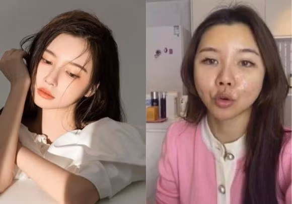 Trong một lần livestream hot girl Mục Nhã Lan khiến người xem thất vọng vì nhan sắc khác xa ảnh.