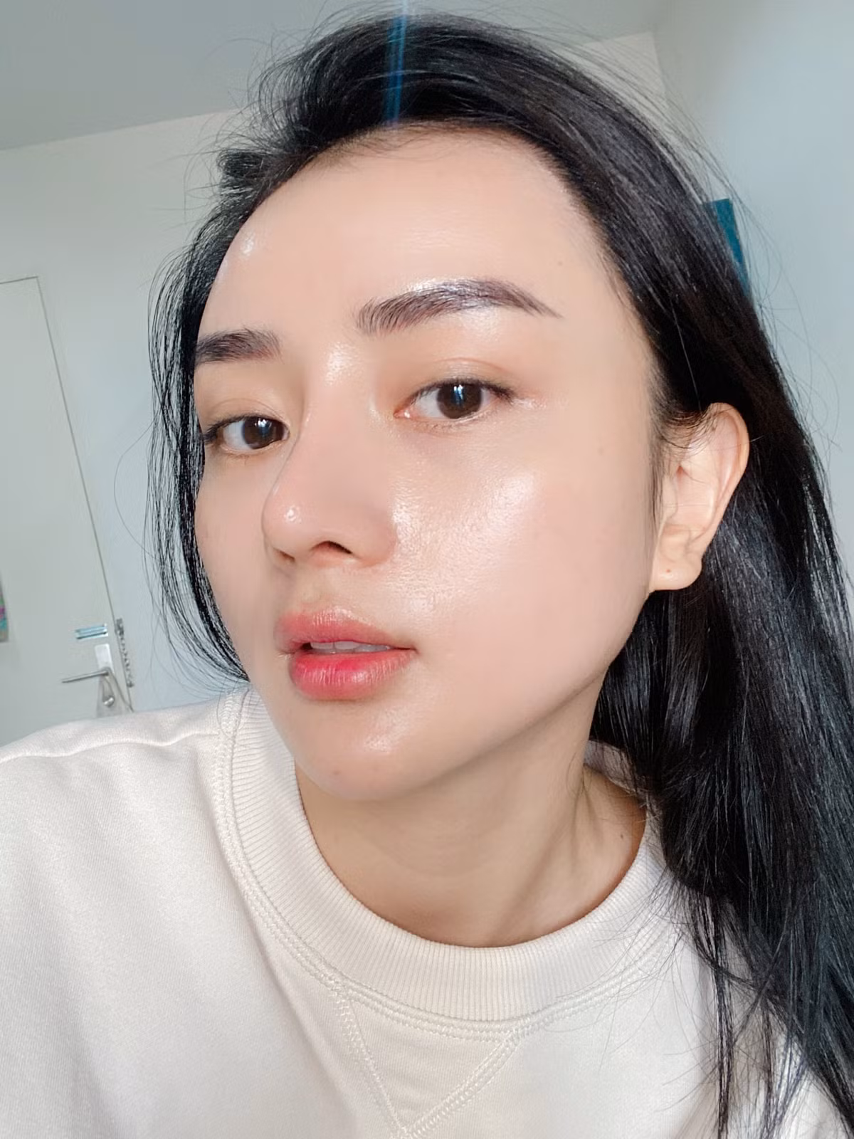 Trước khi kết hôn, Angela Chu đã kể sạch sành sanh cho chồng tỷ phú chuyện cô bỏ ra hơn 205 triệu cho 2 lần phẫu thuật thẩm mỹ của mình.