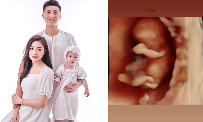 Vợ chồng Phan Văn Đức mới đây đã đón nhận tin vui khi bà xã Nhật Linh mang bầu con thứ hai. Cặp đôi đặt biệt danh cho con là "Khoai Tây".