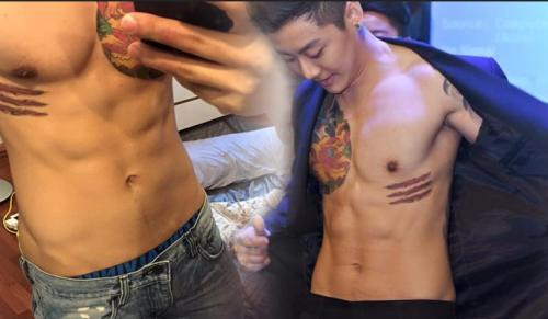 JYB thổ lộ, cơ thể của chàng trai hiện nay cũng bị nhiễm độc nhiều do lượng thuốc tiêm vào cơ thể để thay đổi nội tiết tố. Chàng trai cũng cho hay, những người chuyển đổi giới tính có tuổi thọ thấp hơn người bình thường.