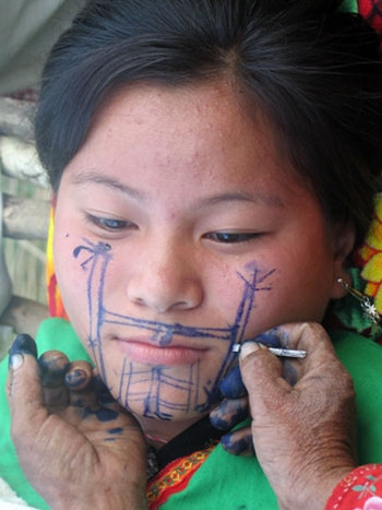 Bi an hinh xam co xua tren co the phu nu Viet Nam