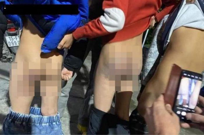  Tạm dừng công tác giáo viên có học sinh bị đánh thâm tím: Ngày 27/1, thông tin từ Phòng Giáo dục huyện Kiến Thụy (Hải Phòng) cho biết, giáo viên Vũ Thị H., chủ nhiệm sinh lớp 3E, Trường Tiểu học Ngũ Đoan đã bị tạm dừng công tác để cơ quan chức năng xác minh, làm rõ trách nhiệm về việc 3 học sinh lớp 3E bị đánh thâm tím mông.