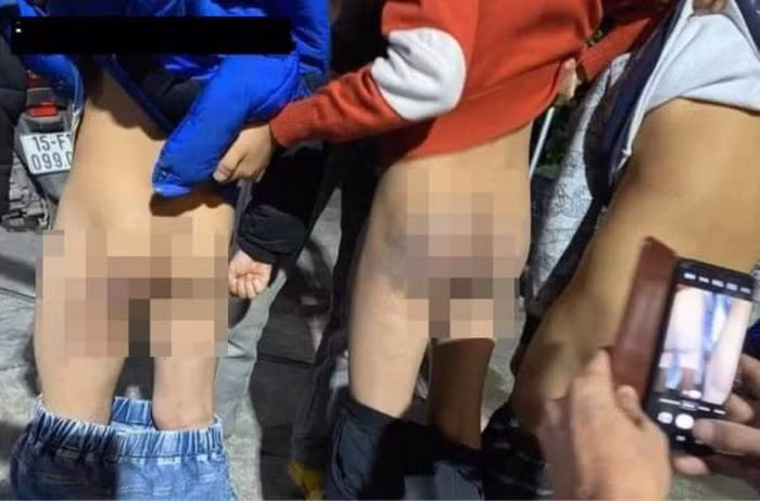  Tạm dừng công tác giáo viên có học sinh bị đánh thâm tím: Ngày 27/1, thông tin từ Phòng Giáo dục huyện Kiến Thụy (Hải Phòng) cho biết, giáo viên Vũ Thị H., chủ nhiệm sinh lớp 3E, Trường Tiểu học Ngũ Đoan đã bị tạm dừng công tác để cơ quan chức năng xác minh, làm rõ trách nhiệm về việc 3 học sinh lớp 3E bị đánh thâm tím mông.