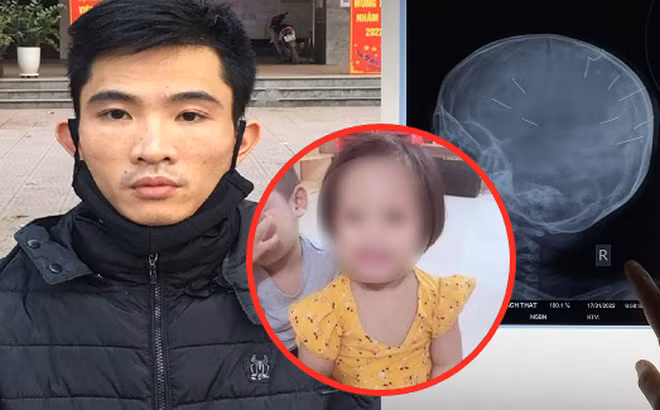 Loi khai cua doi tuong dong dinh vao dau be gai 3 tuoi o Ha Noi-Hinh-3