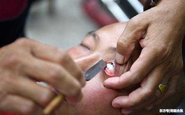 Theo ông Cao Vũ, để có thể dùng dao làm sạch mắt, phải là người có kỹ năng, có tay nghề cao. Nếu không, sẽ khiến khách hàng gặp họa, ảnh hưởng trực tiếp đến thị lực.