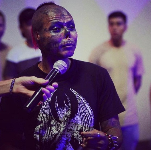 Chuyen la hom nay: Nguoi dan ong gang phau thuat mat thanh dau lau-Hinh-2