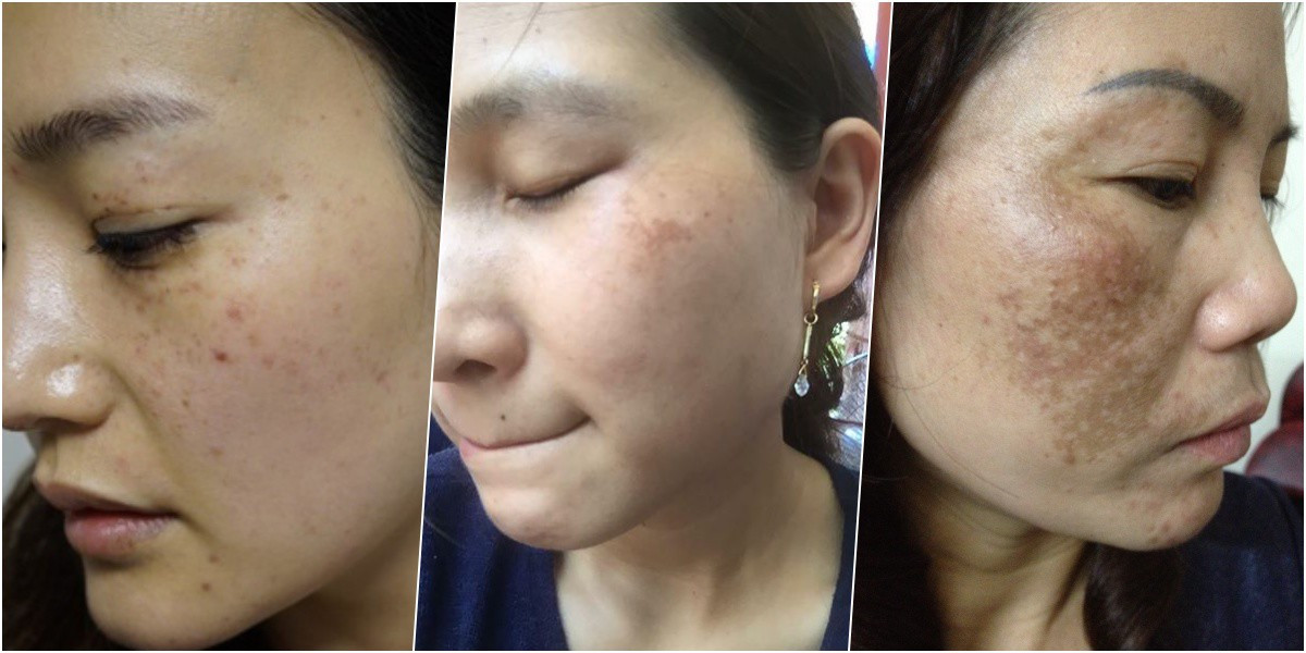 1 loai la chuyen tri nam cuc hieu qua, tim dau cung co-Hinh-2