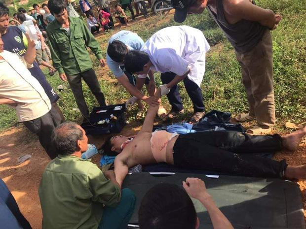 Nguoi dan ong tu rach bung vi nghi trong bung co bom