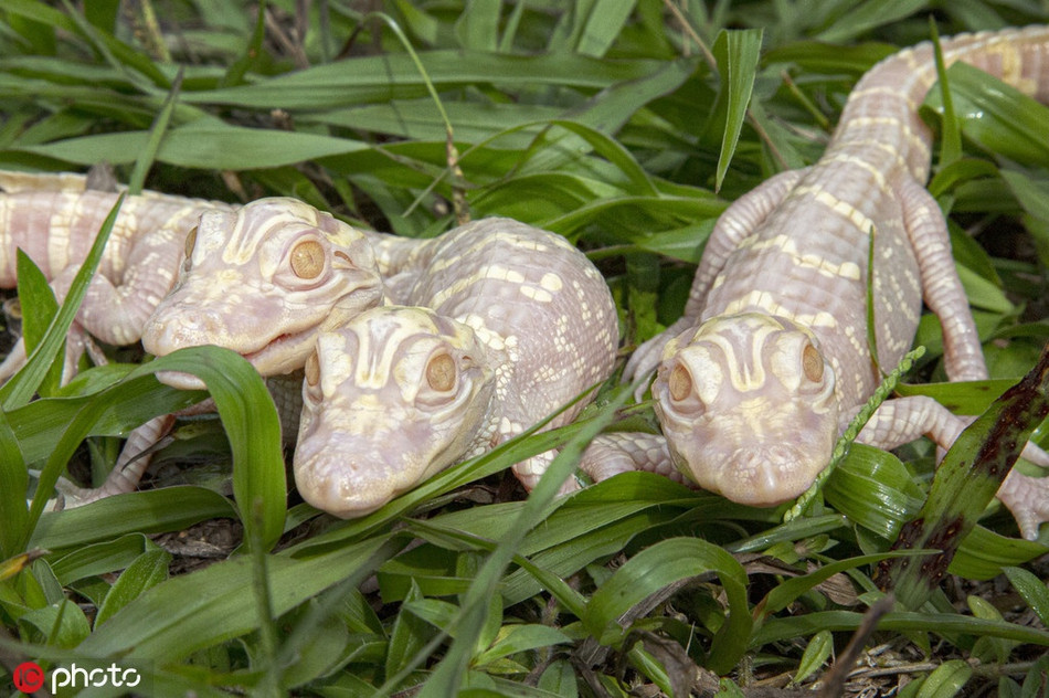 Theo tìm hiểu, bạch tạng (Albinism) là hội chứng bẩm sinh do rối loạn quá trình sinh tổng hợp ra sắc tố melanin, làm cho da, tóc và mắt của người bệnh có màu nhạt. Da của người bị bạch tạng dễ bị bỏng nắng, do đó dễ bị ung thư da. Ngoài ra, bạch tạng còn gây ra rối loạn thị giác, giảm thị lực và sợ ánh sáng.