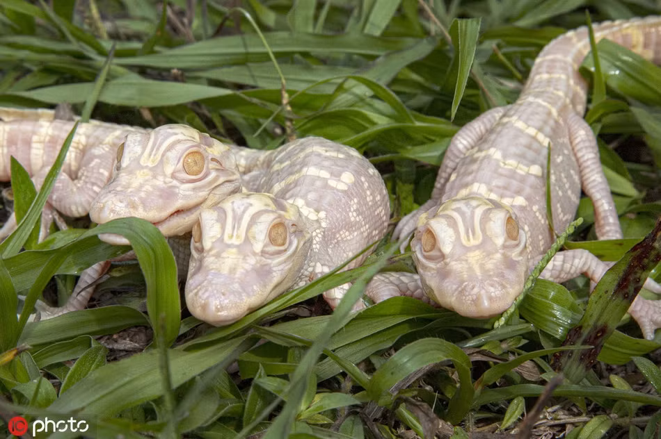 Theo tìm hiểu, bạch tạng (Albinism) là hội chứng bẩm sinh do rối loạn quá trình sinh tổng hợp ra sắc tố melanin, làm cho da, tóc và mắt của người bệnh có màu nhạt. Da của người bị bạch tạng dễ bị bỏng nắng, do đó dễ bị ung thư da. Ngoài ra, bạch tạng còn gây ra rối loạn thị giác, giảm thị lực và sợ ánh sáng.