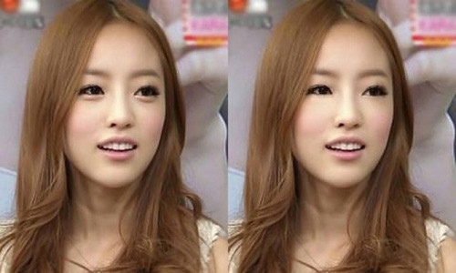 1. Trào lưu tạo bọng mắt cười ở Hàn Quốc: Phụ nữ Hàn Quốc bị ám ảnh bởi vẻ bề ngoài, đặc biệt là với đôi mắt một mí đặc trưng. Phụ nữ luôn có tâm lý phải xinh đẹp và dễ thương như một đứa trẻ. Dựa vào tâm lý đó, trào lưu tạo bọng mắt cười Aegyo ra đời. Phong cách này có thể tạo nên nhờ trang điểm hoặc phẫu thuật tiêm botox vào bọng mắt, giúp mắt nhìn có vẻ to hơn. Ảnh: BS.