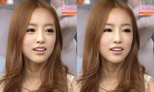 1. Trào lưu tạo bọng mắt cười ở Hàn Quốc: Phụ nữ Hàn Quốc bị ám ảnh bởi vẻ bề ngoài, đặc biệt là với đôi mắt một mí đặc trưng. Phụ nữ luôn có tâm lý phải xinh đẹp và dễ thương như một đứa trẻ. Dựa vào tâm lý đó, trào lưu tạo bọng mắt cười Aegyo ra đời. Phong cách này có thể tạo nên nhờ trang điểm hoặc phẫu thuật tiêm botox vào bọng mắt, giúp mắt nhìn có vẻ to hơn. Ảnh: BS.