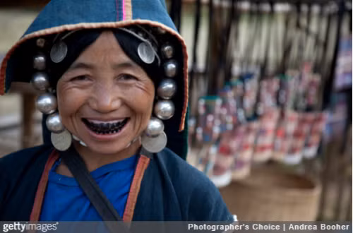 3. Tục nhuộm răng của một số dân tộc ở Việt Nam: Thay vì dành ra 3 lần đánh răng một ngày giúp răng trắng đẹp, phụ nữ của một số dân tộc ở Việt Nam như Thái, Si La, Tày, Dao, La Hủ...lại thích nhuộm răng đen. Ngoài ra, nhuộm răng cũng phổ biến khắp các vùng khác của châu Á. Tại Nhật Bản, nhuộm răng đen là tượng trưng cho một địa vị cao trong xã hội. Ảnh: Getty.