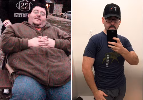 Người đàn ông này đã giảm cân thành công khi loại bỏ được 133kg mỡ thừa. Ảnh: BP.