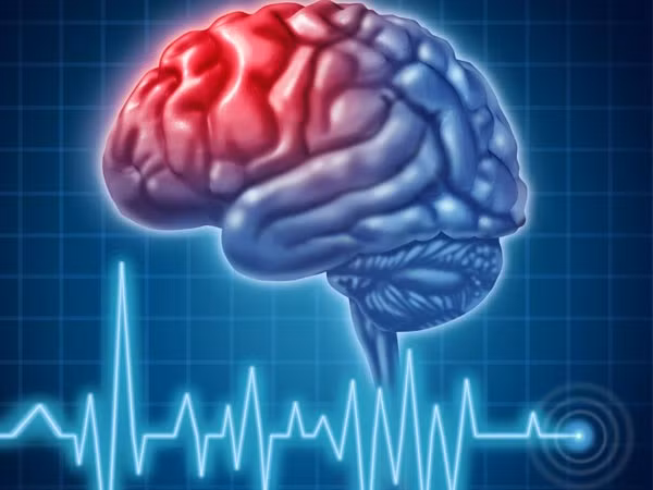 2. Giảm nguy cơ đột quỵ: Hạt lạc có hàm lượng cholesterol tốt cao. Chúng cũng chứa các axit béo Omega 3 khỏe mạnh giúp giảm cholesterol xấu và giữ cho động mạch của chúng ta sạch sẽ. Ảnh: Boldsky.