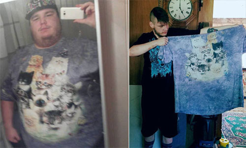 Những hình ảnh này cho thấy cuộc hành trình của Sam từ trước và sau khi phẫu thuật giảm cân. Ảnh: MDW.