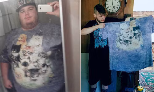 Những hình ảnh này cho thấy cuộc hành trình của Sam từ trước và sau khi phẫu thuật giảm cân. Ảnh: MDW.