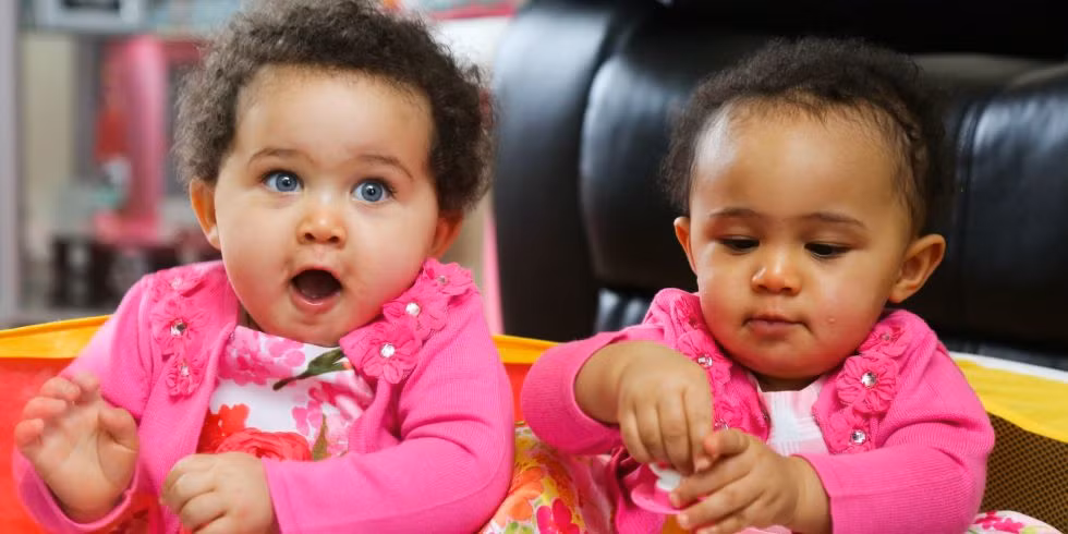 Có những cặp song sinh "cùng trứng" nhưng lại có bề ngoài hoàn toàn khác nhau. Ảnh: BS.