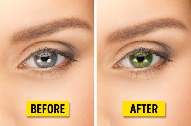 Thay đổi màu mắt. Bác sĩ phẫu thuật có thể cấy ghép một bộ phận giả bằng silicon vào mống mắt bằng cách thực hiện một vết mổ nhỏ trên giác mạc. Bộ phận giả có thể mang bất kỳ màu nào bạn chọn. Ảnh: Depositphotos.