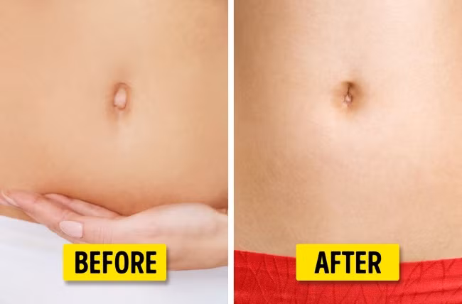 Nếu bạn muốn có một chiếc rốn đẹp, các bác sĩ phẫu thuật cũng có thể giúp bạn thực hiện được. Ảnh: Depositphotos.