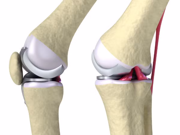 5. Hỗ trợ xương chắc khỏe: Nước ép cà rốt chứa một lượng vitamin K rất cần thiết cho quá trình xây dựng protein trong cơ thể. Nó hỗ trợ trong việc ràng buộc canxi và dẫn đến việc chữa lành nhanh chóng cho những chỗ xương bị gãy. Ảnh: Boldsky.