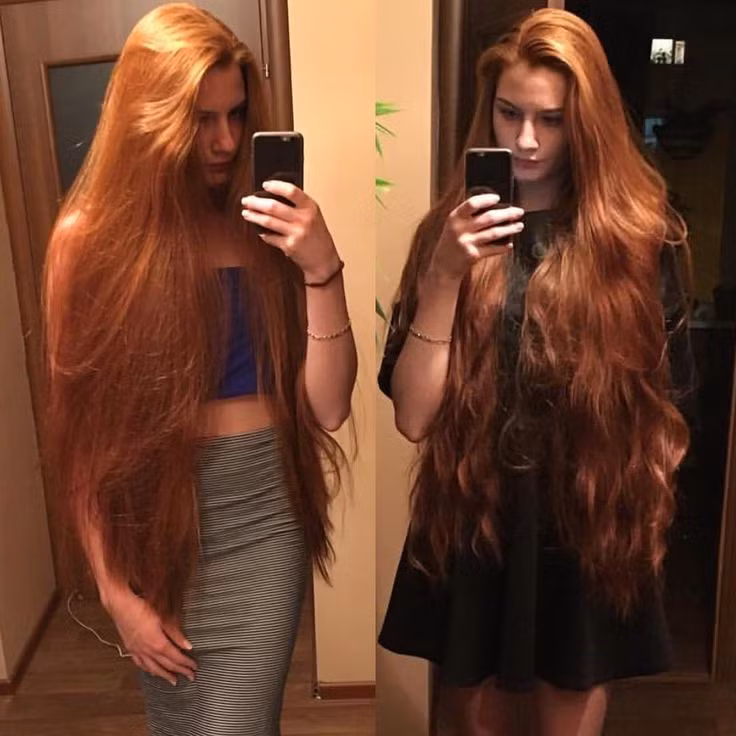 Nhìn mái tóc dài mượt, không ai nghĩ rằng cô từng bị chuẩn đoán mắc chứng rụng tóc androgenetic - một tình trạng dẫn đến tóc rơi ra để lại những mảng vảy trầy xước khổng lồ từ thời niên thiếu. Ảnh: Instagram.