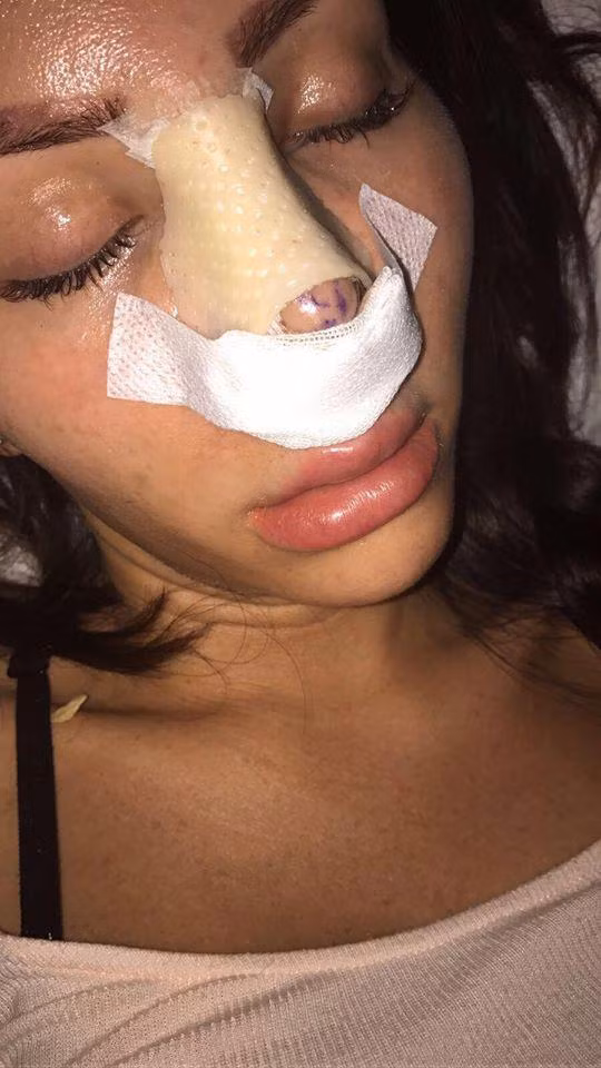 Nói về quyết định làm đẹp bằng dao kéo của mình, cô giải thích: "Tôi muốn biến đổi bản thân mình, tôi muốn trở thành giống như Barbie”. Star cho rằng phẫu thuật thẩm mỹ chính là một lối thoát khỏi tuổi thơ không hạnh phúc của cô. Ảnh: Thesun.