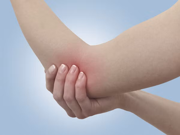 Đôi khi, bạn sẽ nhận thấy các vết thâm tím xuất hiện trên cơ thể dù bạn không hề bị thương, điều này là do thiếu vitamin C trong chế độ ăn uống. Ảnh: Boldsky.