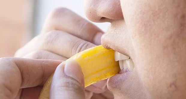 7. Vỏ chuối: Cùng với vỏ cam thì vỏ chuối cũng có tác dụng tương tự. Sử dụng phần trong của vỏ chuối chà xát lên hàm trăng 4 – 5 phút, sau đó thực hiện bước đánh răng như thường lệ. Thực hiện 4 lần trong tuần, bạn sẽ nhận thấy sự mờ dần các vết ố vàng trên thân răng. Ảnh: WP.
