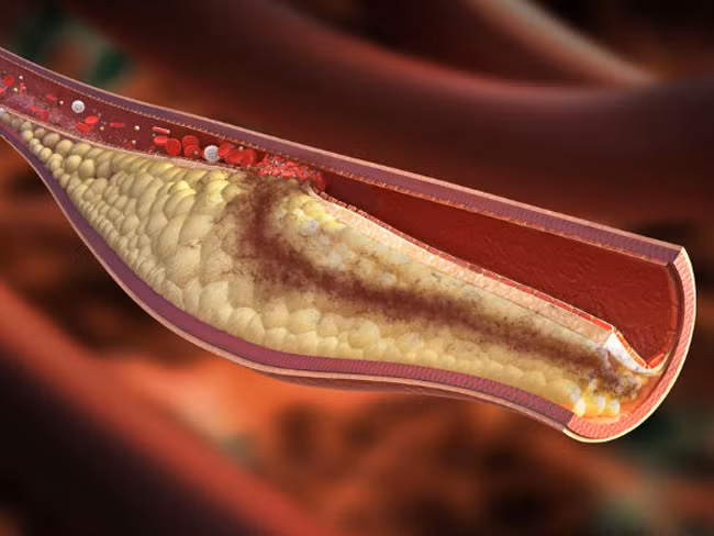 7. Giảm cholesterol: nếu đang cần giảm nồng độ cholesterol trong máu, bạn nên ăn dưa lưới hằng ngày vì loại trái cây này hoàn toàn không chứa cholesterol.