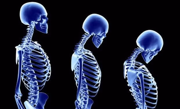 14. Khi mới sinh, cơ thể người có 300 xương, nhưng khi trưởng thành chỉ còn 206. Phần lớn chúng không hề biến mất mà do kết hợp lại với nhau. Ảnh: CDN.