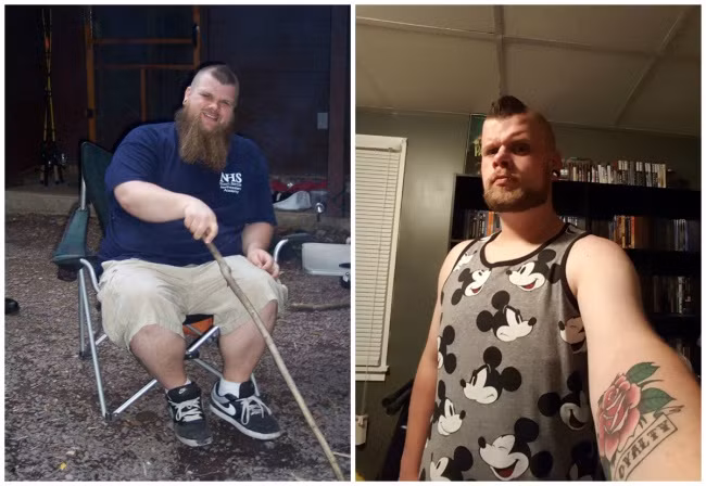 Trong một năm, anh ta giảm cân ngoạn mục và loại bỏ được 45kg mỡ thừa nhờ cách chạy bộ, ăn nhiều rau và thường xuyên tới phòng tập thể dục. Ảnh: Imgur.