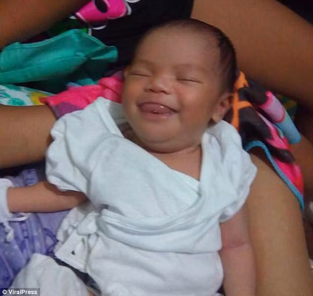 Tình trạng của Zhyrille bắt đầu từ lúc cô bé chào đời. Ảnh: Viralpress.