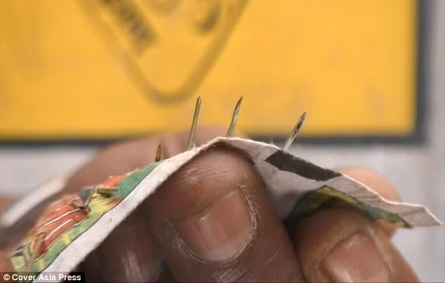 "Chúng tôi đã chụp X-quang toàn thân cho cô ấy và phát hiện 70 loại kim sắt khác nhau ở chân dưới đầu gối. Về mặt y khoa, không thể cho các cây kim như vậy phát triển trong cơ thể con người. Cho đến nay, chúng tôi chưa thể xác nhận làm thế nào mà kim châm vào cơ thể cô ấy nhưng chúng tôi nghi ngờ bệnh nhân đã tự làm hại mình”, bác sĩ Vishal chia sẻ. Ảnh: CAP.