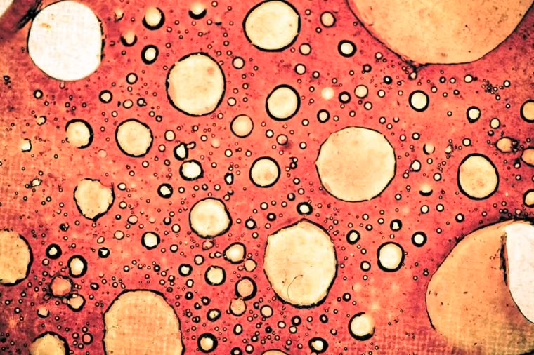 10. Số lượng lớn tế bào da: Con người có 300 triệu tế bào da, tương ứng với hơn 15.000 tế bào da/1 centimet vuông của cơ thể. Các xung điện di chuyển trong những tế bào da với tốc độ trên 400km/h. Ảnh: Shutterstock.