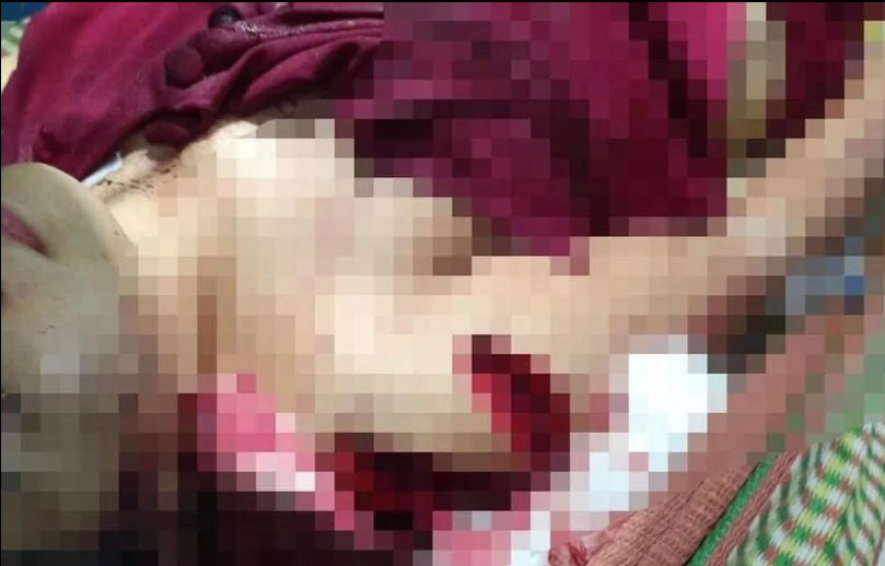  Lên cơn ghen, chồng chém vợ 8 nhát dao: Trong lúc xảy ra cãi vã, Vũ Văn Hoàn (SN 1989, trú xã Hồng Ca, huyện Trấn Yên, Yên Bái) không kiềm chế được đã dùng dao chém vợ là chị Hoàng Thị T.T (SN 1990) trọng thương với 8 nhát dao. Ngay sau khi sự việc xảy ra, nạn nhân đã được đưa đi cấp cứu kịp thời, hiện đã qua cơn nguy kịch. Ngày 30/7, Công an huyện Trấn Yên cho biết đang phối hợp với Công an xã Hồng Ca tiến hành điều tra, xử lý vụ việc.