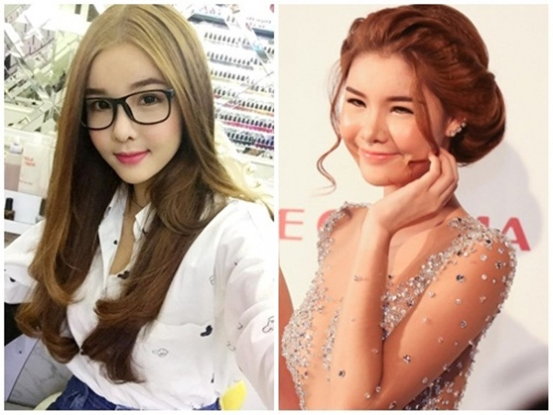 "Thời điểm này tôi bị khủng hoảng sợ khuôn mặt mình bị biến dạng vì phẫu thuật thẩm mỹ. Nhưng thật may mắn bây giờ đã đâu vào đó", Kỳ Hân viết. Ảnh: Người Đưa Tin