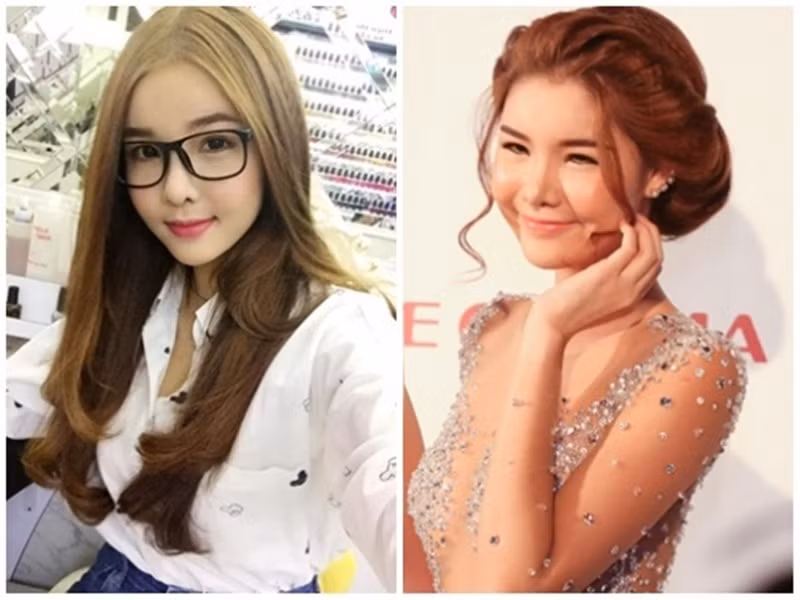 "Thời điểm này tôi bị khủng hoảng sợ khuôn mặt mình bị biến dạng vì phẫu thuật thẩm mỹ. Nhưng thật may mắn bây giờ đã đâu vào đó", Kỳ Hân viết. Ảnh: Người Đưa Tin