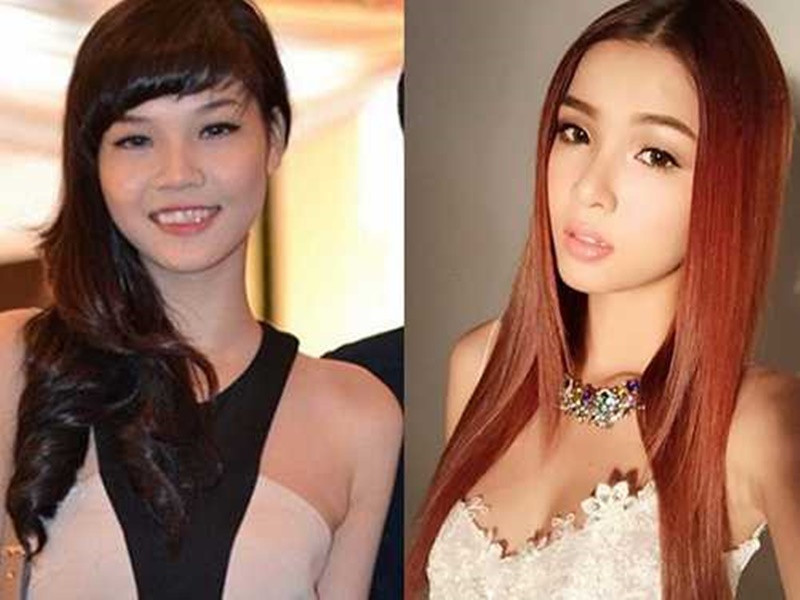 Ngoài chỉnh sửa răng, Kỳ Hân dao kéo mũi không ít lần. Ảnh: Khám Phá