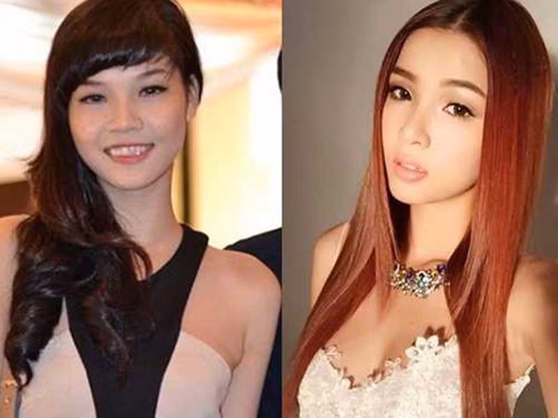 Ngoài chỉnh sửa răng, Kỳ Hân dao kéo mũi không ít lần. Ảnh: Khám Phá