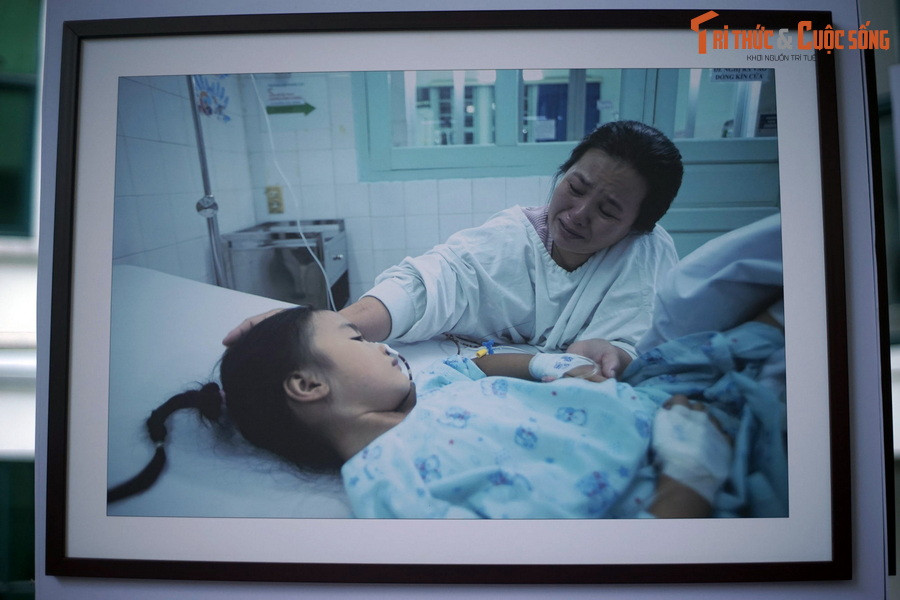  Con đau, mẹ đau: Bé Thương, một bệnh nhân được phẫu thuật theo chương trình từ thiện của quỹ "Thiện nhân và những người bạn" vừa rời phòng mổ. Em rất đau khiến mẹ không cầm được nước mắt.