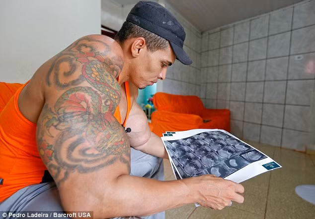 Do các độc tố trong dầu và rượu tiêm vào cơ thể, anh này bị đau liên tục và gần như bị suy thận nghiêm trọng.